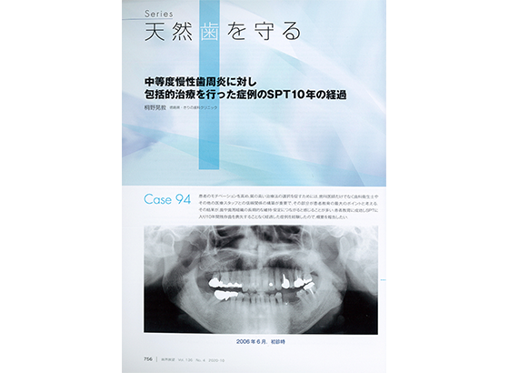 歯界展望 天然歯を守る