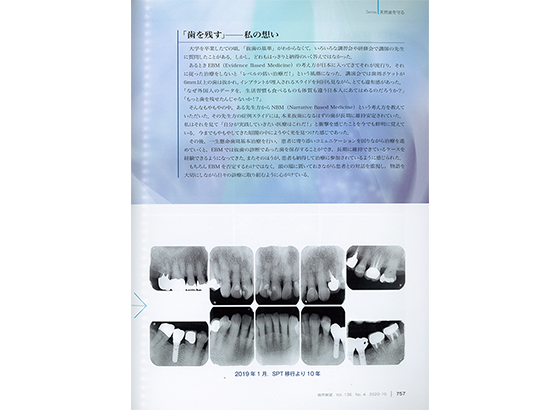 歯界展望 歯を残すー私の思い