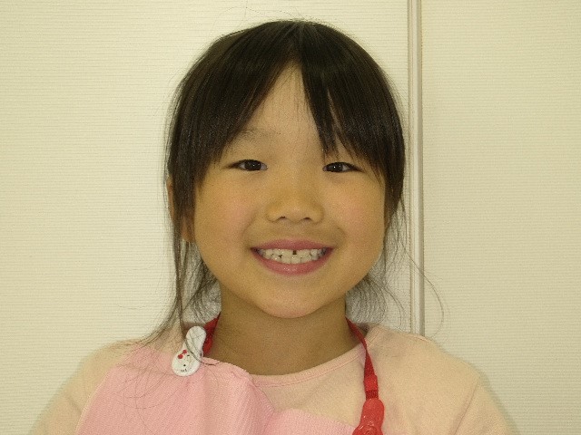 さくらちゃん